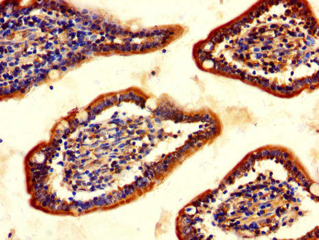 CHAT Antibody - Immunohistochemistry of paraffin-embedded human small intestine tissue using CHAT Antibody at dilution of 1:100