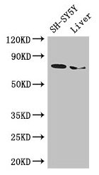 CHAT Antibody - Western Blot Positive WB detected in: SH-SY5Y whole cell lysate, Mouse liver tissue All lanes: CHAT antibody at 3µg/ml Secondary Goat polyclonal to rabbit IgG at 1/50000 dilution Predicted band size: 83, 75, 71 kDa Observed band size: 75 kDa