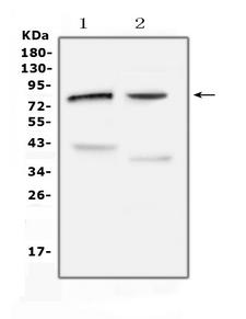 CHAT Antibody - Western blot analysis of CHAT using anti-CHAT antibody. Electrophoresis was performed on a 5-20% SDS-PAGE gel at 70V (Stacking gel) / 90V (Resolving gel) for 2-3 hours. The sample well of each lane was loaded with 50ug of sample under reducing conditions. Lane 1: rat testis tissue lysates, Lane 2: mouse testis tissue lysates. After Electrophoresis, proteins were transferred to a Nitrocellulose membrane at 150mA for 50-90 minutes. Blocked the membrane with 5% Non-fat Milk/ TBS for 1.5 hour at RT. The membrane was incubated with rabbit anti-CHAT antigen affinity purified polyclonal antibody at 0.5 µg/mL overnight at 4°C, then washed with TBS-0.1% Tween 3 times with 5 minutes each and probed with a goat anti-rabbit IgG-HRP secondary antibody at a dilution of 1:10000 for 1.5 hour at RT. The signal is developed using an Enhanced Chemiluminescent detection (ECL) kit with Tanon 5200 system. A specific band was detected for CHAT at approximately 83KD. The expected band size for CHAT is at 83KD.