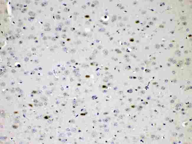 CHAT Antibody - IHC analysis of CHAT using anti-CHAT antibody. CHAT was detected in paraffin-embedded section of mouse brain tissues. Heat mediated antigen retrieval was performed in citrate buffer (pH6, epitope retrieval solution) for 20 mins. The tissue section was blocked with 10% goat serum. The tissue section was then incubated with 1µg/ml rabbit anti-CHAT Antibody overnight at 4°C. Biotinylated goat anti-rabbit IgG was used as secondary antibody and incubated for 30 minutes at 37°C. The tissue section was developed using Strepavidin-Biotin-Complex (SABC) with DAB as the chromogen.
