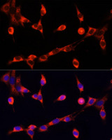 CHAT Antibody - Immunofluorescence analysis of NIH/3T3 cells using CHAT antibody at dilution of 1:100. Blue: DAPI for nuclear staining.