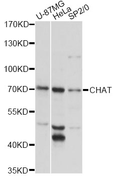 CHAT Antibody - Western blot analysis of extracts of various cell lines, using CHAT antibody at 1:3000 dilution. The secondary antibody used was an HRP Goat Anti-Rabbit IgG (H+L) at 1:10000 dilution. Lysates were loaded 25ug per lane and 3% nonfat dry milk in TBST was used for blocking. An ECL Kit was used for detection and the exposure time was 10s.