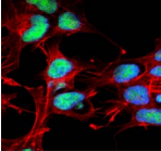CHAT Antibody - Detection of choline acetyltransferase in human neuroblastoma cell line SK-N-BE with Choline Acetyltransferase Polyclonal Antibody diluted 1:100. DAPI (blue) nuclear stain, Texas red actin stain, and FITC (green) choline acetyltransferase stain.