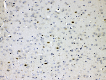 CHAT Antibody - IHC testing of FFPE mouse brain tissue with Choline acetyltransferase antibody at 1ug/ml. Required HIER: steam section in pH6 citrate buffer for 20 min and allow to cool prior to testing.