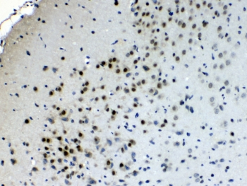 CHAT Antibody - IHC testing of FFPE rat brain tissue with Choline acetyltransferase antibody at 1ug/ml. Required HIER: steam section in pH6 citrate buffer for 20 min and allow to cool prior to testing.