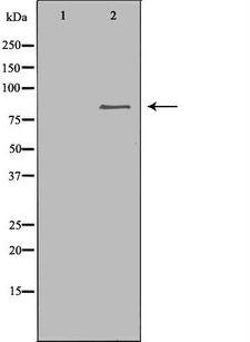 CHAT Antibody - Western blot analysis of extracts of COLO using CHAT antibody. The lane on the left is treated with the antigen-specific peptide.