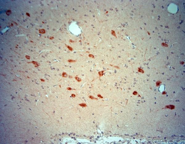 CHAT Antibody - IHC-P on paraffin sections of rat brain. The animal was perfused using Autoperfuser at a pressure of 130 mmHg with 300 ml 4% FA being processed for paraffin embedding. HIER: Tris-EDTA, pH 9 for 20 min using Thermo PT Module. Blocking: 0.2% LFDM in TBST filtered through 0.2 µm. Detection was done using Novolink HRP polymer from Leica following manufacturers instructions; DAB chromogen: Candela DAB chromogen. Primary antibody: dilution 1:250, incubated 30 min at RT using Autostainer. Sections were counterstained with Harris Hematoxylin.