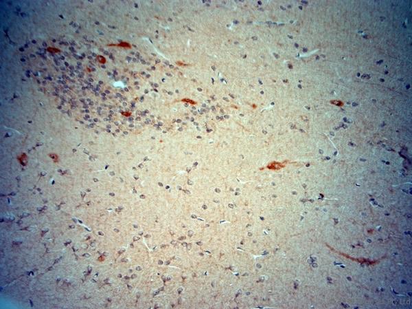 CHAT Antibody - IHC-P on paraffin sections of rat brain. The animal was perfused using Autoperfuser at a pressure of 130 mmHg with 300 ml 4% FA being processed for paraffin embedding. HIER: Tris-EDTA, pH 9 for 20 min using Thermo PT Module. Blocking: 0.2% LFDM in TBST filtered through 0.2 µm. Detection was done using Novolink HRP polymer from Leica following manufacturers instructions; DAB chromogen: Candela DAB chromogen. Primary antibody: dilution 1:250, incubated 30 min at RT using Autostainer. Sections were counterstained with Harris Hematoxylin.