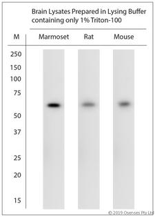 CHAT Antibody - WB on brain lysates. Blocking: 1% LFDM for 30 min at RT; primary antibody dilution 1:500 incubated at 4°C overnight.