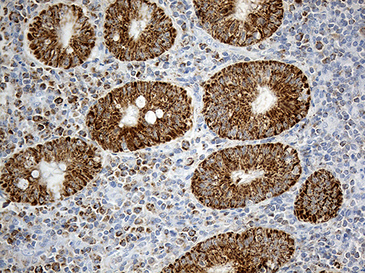 CHCHD10 Antibody - Immunohistochemical staining of paraffin-embedded Human appendix tissue within the normal limits using anti-CHCHD10 mouse monoclonal antibody. (Heat-induced epitope retrieval by 1mM EDTA in 10mM Tris buffer. (pH8.5) at 120°C for 3 min. (1:500)