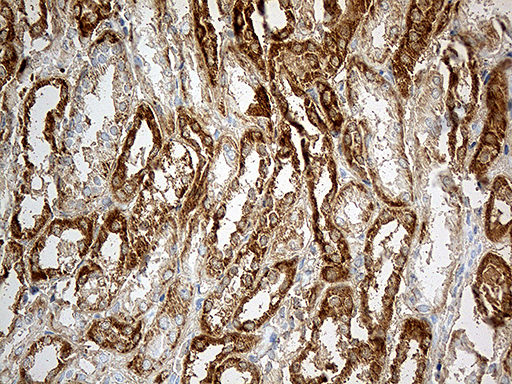 CHCHD10 Antibody - Immunohistochemical staining of paraffin-embedded Human Kidney tissue within the normal limits using anti-CHCHD10 mouse monoclonal antibody. (Heat-induced epitope retrieval by 1mM EDTA in 10mM Tris buffer. (pH8.5) at 120°C for 3 min. (1:500)
