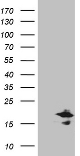 CHCHD10 Antibody - HEK293T cells were transfected with the pCMV6-ENTRY control. (Left lane) or pCMV6-ENTRY CHCHD10. (Right lane) cDNA for 48 hrs and lysed