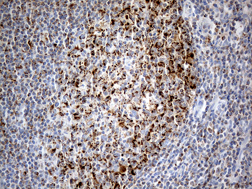 CHCHD10 Antibody - Immunohistochemical staining of paraffin-embedded Human tonsil within the normal limits using anti-CHCHD10 mouse monoclonal antibody. (Heat-induced epitope retrieval by 1mM EDTA in 10mM Tris buffer. (pH8.5) at 120°C for 3 min. (1:500)