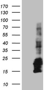 CHCHD10 Antibody - HEK293T cells were transfected with the pCMV6-ENTRY control. (Left lane) or pCMV6-ENTRY CHCHD10. (Right lane) cDNA for 48 hrs and lysed