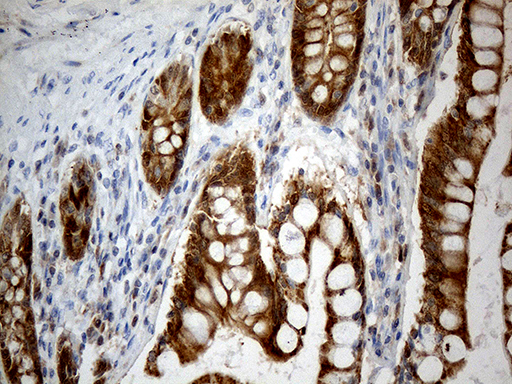 CHCHD10 Antibody - Immunohistochemical staining of paraffin-embedded Human colon tissue within the normal limits using anti-CHCHD10 mouse monoclonal antibody. (Heat-induced epitope retrieval by 1mM EDTA in 10mM Tris buffer. (pH8.5) at 120°C for 3 min. (1:500)