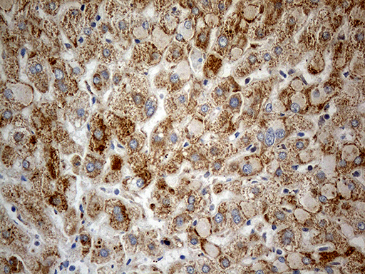 CHCHD10 Antibody - Immunohistochemical staining of paraffin-embedded Human liver tissue within the normal limits using anti-CHCHD10 mouse monoclonal antibody. (Heat-induced epitope retrieval by 1mM EDTA in 10mM Tris buffer. (pH8.5) at 120°C for 3 min. (1:500)