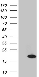 CHCHD10 Antibody - HEK293T cells were transfected with the pCMV6-ENTRY control. (Left lane) or pCMV6-ENTRY CHCHD10. (Right lane) cDNA for 48 hrs and lysed