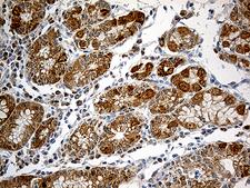 CHCHD10 Antibody - Immunohistochemical staining of paraffin-embedded Human gastric tissue within the normal limits using anti-CHCHD10 mouse monoclonal antibody. (Heat-induced epitope retrieval by 1mM EDTA in 10mM Tris buffer. (pH8.5) at 120°C for 3 min. (1:500)