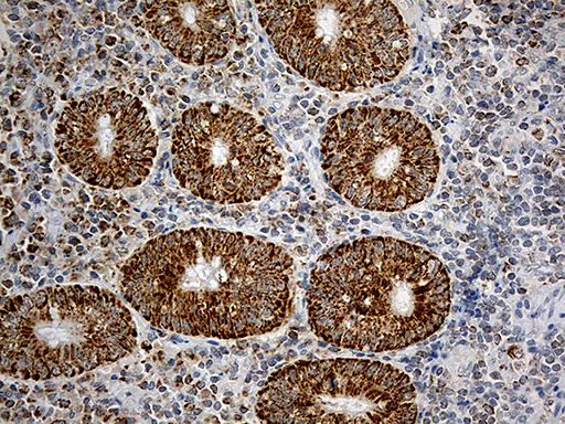 CHCHD10 Antibody - Immunohistochemical staining of paraffin-embedded Human appendix tissue within the normal limits using anti-CHCHD10 mouse monoclonal antibody. (Heat-induced epitope retrieval by 1mM EDTA in 10mM Tris buffer. (pH8.5) at 120°C for 3 min. (1:500)