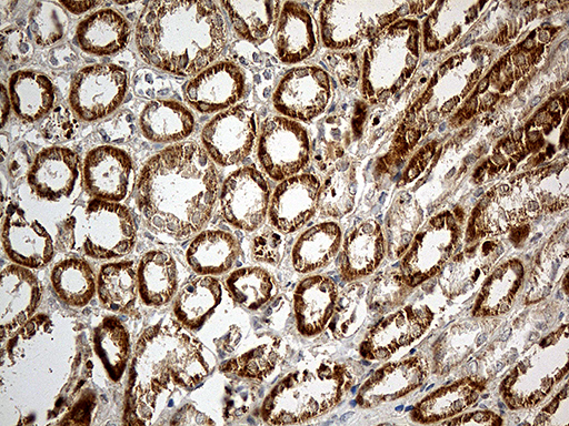 CHCHD10 Antibody - Immunohistochemical staining of paraffin-embedded Human Kidney tissue within the normal limits using anti-CHCHD10 mouse monoclonal antibody. (Heat-induced epitope retrieval by 1mM EDTA in 10mM Tris buffer. (pH8.5) at 120°C for 3 min. (1:500)