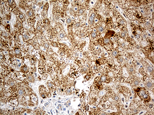 CHCHD10 Antibody - Immunohistochemical staining of paraffin-embedded Human liver tissue within the normal limits using anti-CHCHD10 mouse monoclonal antibody. (Heat-induced epitope retrieval by 1mM EDTA in 10mM Tris buffer. (pH8.5) at 120°C for 3 min. (1:500)