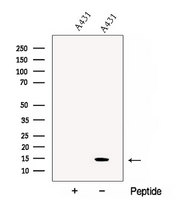 CHCHD10 Antibody - Western blot analysis of extracts of A431 cells using CHCHD10 antibody. The lane on the left was treated with blocking peptide.