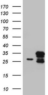 CHCHD3 Antibody - HEK293T cells were transfected with the pCMV6-ENTRY control (Left lane) or pCMV6-ENTRY CHCHD3 (Right lane) cDNA for 48 hrs and lysed. Equivalent amounts of cell lysates (5 ug per lane) were separated by SDS-PAGE and immunoblotted with anti-CHCHD3.
