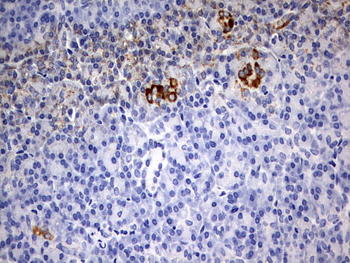 CHCHD3 Antibody - IHC of paraffin-embedded Human pancreas tissue using anti-CHCHD3 mouse monoclonal antibody. (Heat-induced epitope retrieval by 10mM citric buffer, pH6.0, 120°C for 3min).