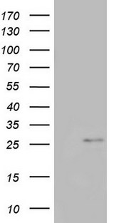 CHCHD3 Antibody - HEK293T cells were transfected with the pCMV6-ENTRY control (Left lane) or pCMV6-ENTRY CHCHD3 (Right lane) cDNA for 48 hrs and lysed. Equivalent amounts of cell lysates (5 ug per lane) were separated by SDS-PAGE and immunoblotted with anti-CHCHD3.