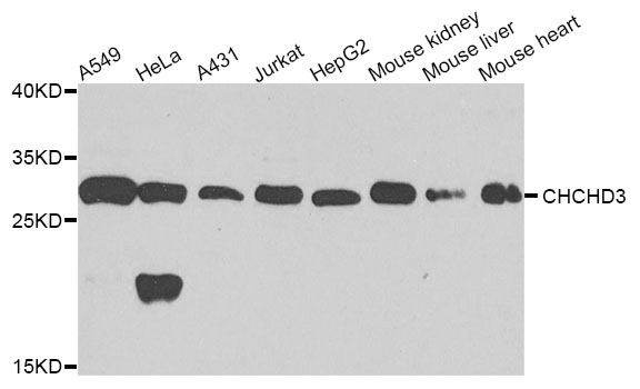 CHCHD3 Antibody - Western blot analysis of extracts of various cell lines.
