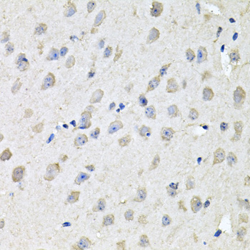 CHCHD3 Antibody - Immunohistochemistry of paraffin-embedded mouse brain tissue.