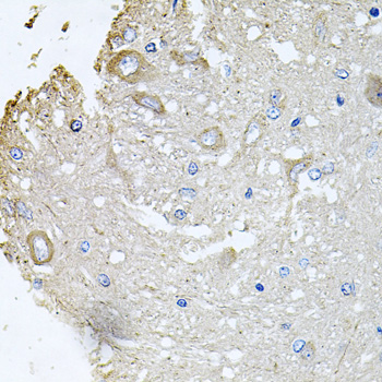 CHCHD3 Antibody - Immunohistochemistry of paraffin-embedded rat brain tissue.