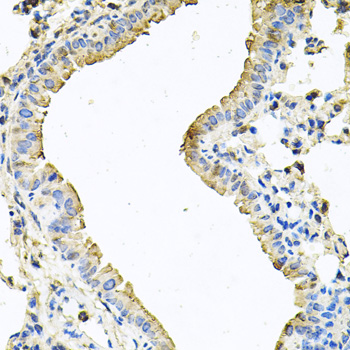 CHCHD3 Antibody - Immunohistochemistry of paraffin-embedded mouse lung tissue.