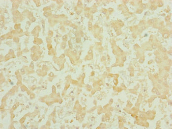 CHCHD3 Antibody - Immunohistochemistry of paraffin-embedded human liver tissue at dilution of 1:100
