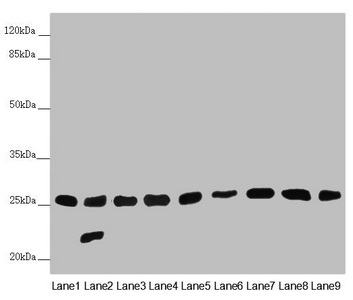 CHCHD3 Antibody - Western blot All Lanes:CHCHD3 antibody at 0.56 ug/ml Lane 1: Mouse heart tissue Lane 2: Mouse kidney tissue Lane 3: Mouse lung tissue Lane 4: Human placenta tissue Lane 5: A549 whole cell lysate Lane 6: HepG-2 whole cell lysate Lane 7: 293T whole cell lysate Lane 8: Jurkat whole cell lysate Lane 9: Hela whole cell lysate Secondary Goat polyclonal to rabbit IgG at 1/10000 dilution Predicted band size: 26 kDa Observed band size: 26,22 kDa