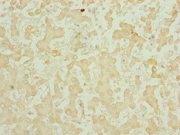 CHCHD3 Antibody - Immunohistochemistry of paraffin-embedded human liver tissue at dilution of 1:100