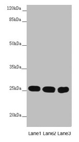 CHCHD3 Antibody - Western blot All lanes: CHCHD3 antibody at 1.67µg/ml Lane 1: Mouse lung tissue Lane 2: HepG2 whole cell lysate Lane 3: Hela whole cell lysate Secondary Goat polyclonal to rabbit IgG at 1/10000 dilution Predicted band size: 26 kDa Observed band size: 26 kDa