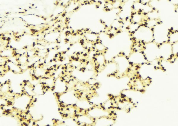 CHCHD3 Antibody - 1:100 staining mouse lung tissue by IHC-P. The sample was formaldehyde fixed and a heat mediated antigen retrieval step in citrate buffer was performed. The sample was then blocked and incubated with the antibody for 1.5 hours at 22°C. An HRP conjugated goat anti-rabbit antibody was used as the secondary.