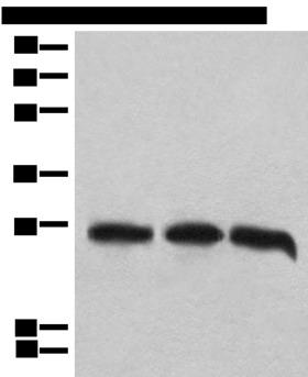 CHCHD3 Antibody - Western blot analysis of 293T cell lysates  using CHCHD3 Polyclonal Antibody at dilution of 1:1000