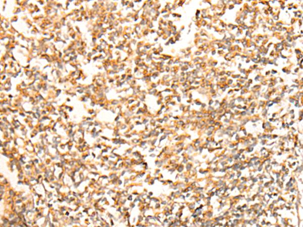 CHCHD3 Antibody - Immunohistochemistry of paraffin-embedded Human tonsil tissue  using CHCHD3 Polyclonal Antibody at dilution of 1:25(×200)