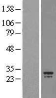 CHCHD3 Protein - Western validation with an anti-DDK antibody * L: Control HEK293 lysate R: Over-expression lysate