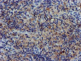 CHCHD5 Antibody - IHC of paraffin-embedded Human lymphoma tissue using anti-CHCHD5 mouse monoclonal antibody.