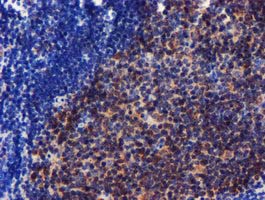 CHCHD5 Antibody - IHC of paraffin-embedded Human tonsil using anti-CHCHD5 mouse monoclonal antibody.