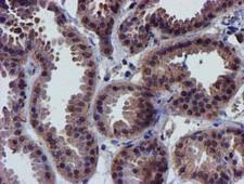 CHCHD5 Antibody - IHC of paraffin-embedded Human breast tissue using anti-CHCHD5 mouse monoclonal antibody.