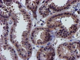 CHCHD5 Antibody - IHC of paraffin-embedded Human breast tissue using anti-CHCHD5 mouse monoclonal antibody.