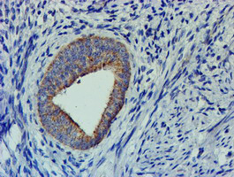 CHCHD5 Antibody - IHC of paraffin-embedded Human endometrium tissue using anti-CHCHD5 mouse monoclonal antibody.