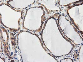 CHCHD5 Antibody - IHC of paraffin-embedded Human thyroid tissue using anti-CHCHD5 mouse monoclonal antibody. (Heat-induced epitope retrieval by 10mM citric buffer, pH6.0, 100C for 10min).