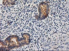 CHCHD5 Antibody - IHC of paraffin-embedded Human endometrium tissue using anti-CHCHD5 mouse monoclonal antibody. (Heat-induced epitope retrieval by 10mM citric buffer, pH6.0, 100C for 10min).