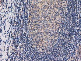 CHCHD5 Antibody - IHC of paraffin-embedded Human lymph node tissue using anti-CHCHD5 mouse monoclonal antibody. (Heat-induced epitope retrieval by 10mM citric buffer, pH6.0, 100C for 10min).
