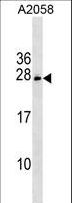 CHCHD6 Antibody - CHCHD6 Antibody western blot of A2058 cell line lysates (35 ug/lane). The CHCHD6 antibody detected the CHCHD6 protein (arrow).